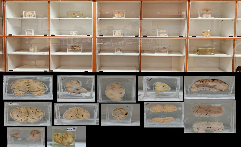 Brain Museum — Eastern India's First — Photo 45