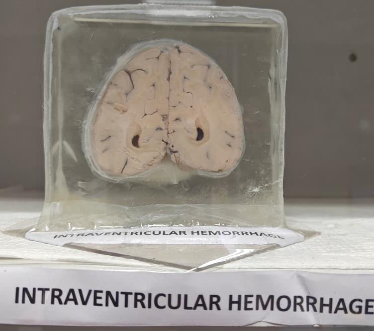 Brain Museum — Eastern India's First — Photo 47
