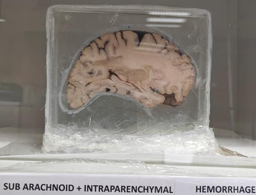 Brain Museum — Eastern India's First — Photo 48