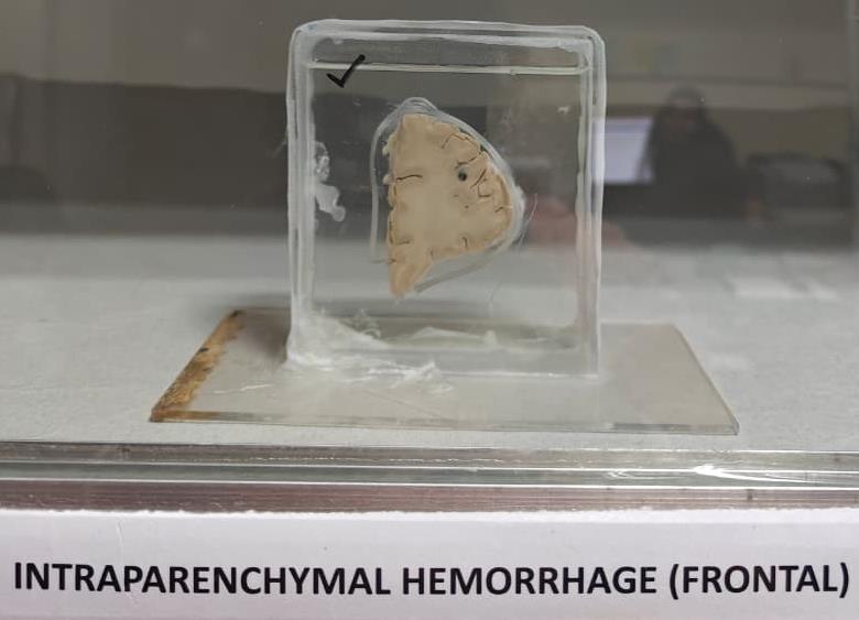 Brain Museum — Eastern India's First — Photo 49