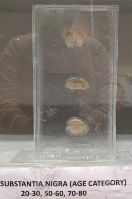 Brain Museum — Eastern India's First — Photo 50