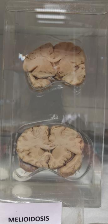Brain Museum — Eastern India's First — Photo 51
