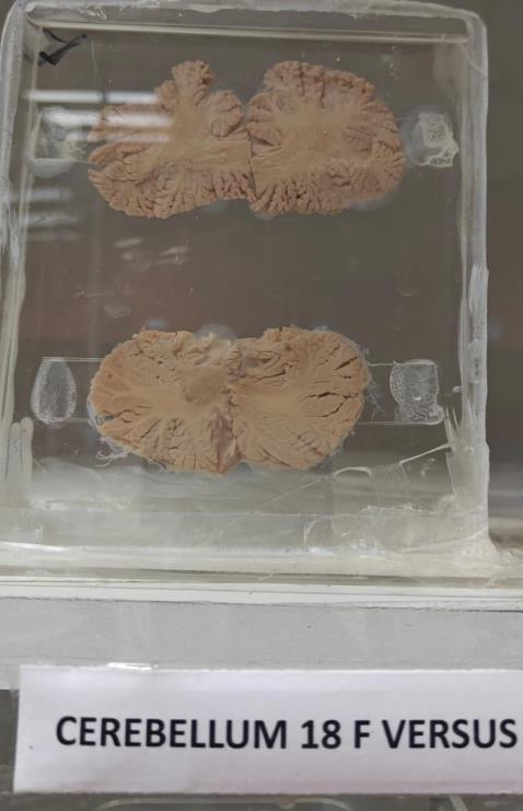 Brain Museum — Eastern India's First — Photo 52