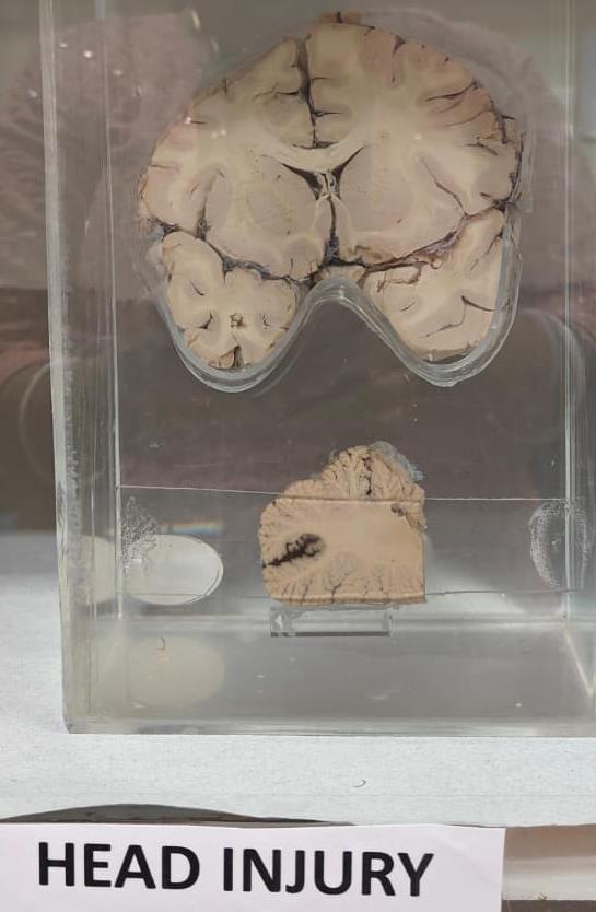 Brain Museum — Eastern India's First — Photo 53