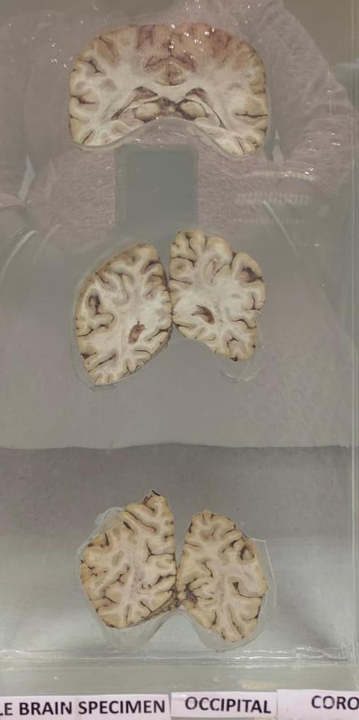 Brain Museum — Eastern India's First — Photo 55