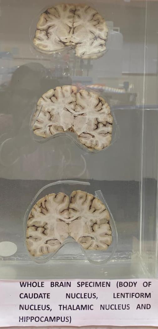 Brain Museum — Eastern India's First — Photo 56
