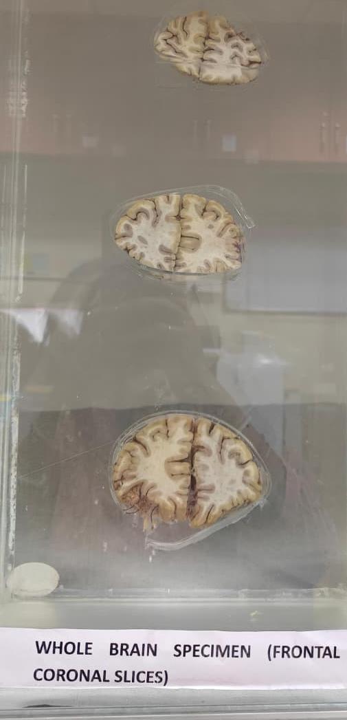 Brain Museum — Eastern India's First — Photo 57