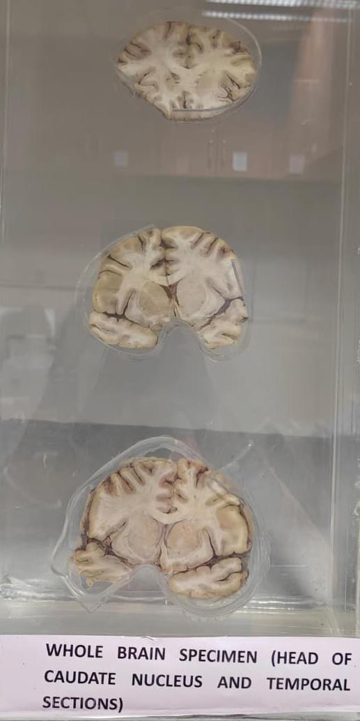 Brain Museum — Eastern India's First — Photo 58