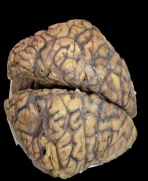 Brain Museum — Eastern India's First — Photo 64