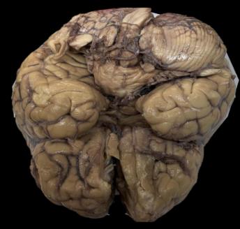 Brain Museum — Eastern India's First — Photo 65