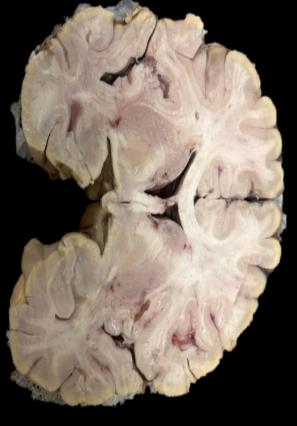 Brain Museum — Eastern India's First — Photo 66