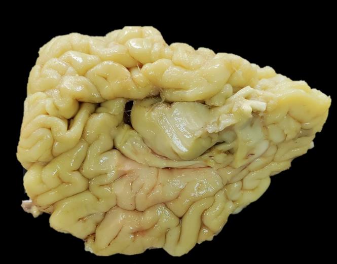 Brain Museum — Eastern India's First — Photo 67