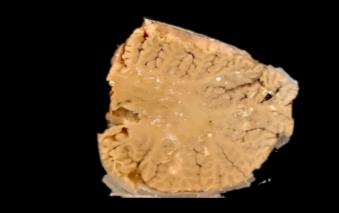 Brain Museum — Eastern India's First — Photo 69
