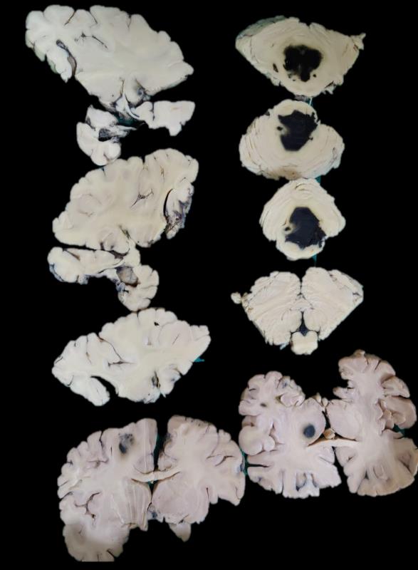 Brain Museum — Eastern India's First — Photo 71