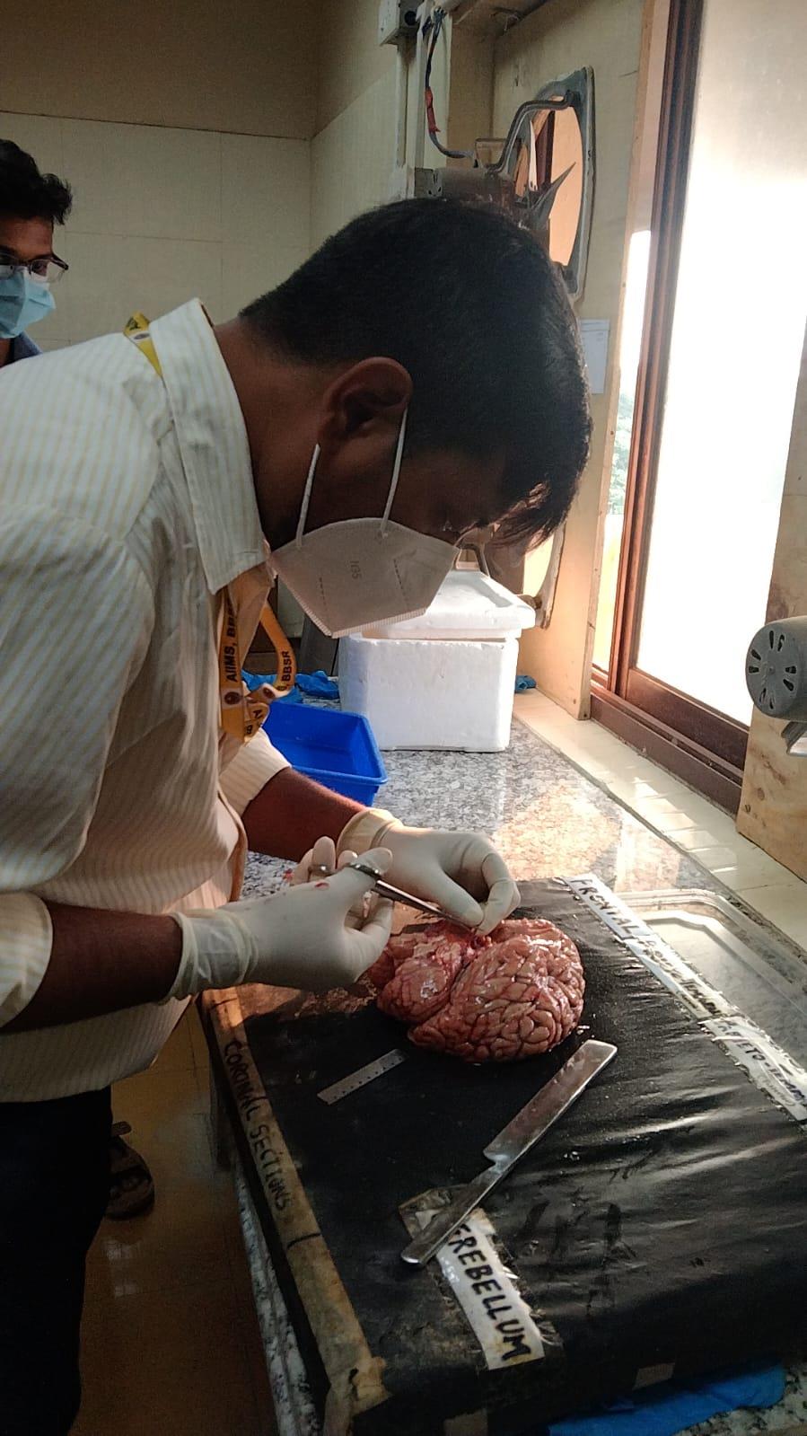 Brain Bank activity image 19