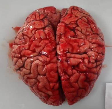 Brain Bank activity image 20