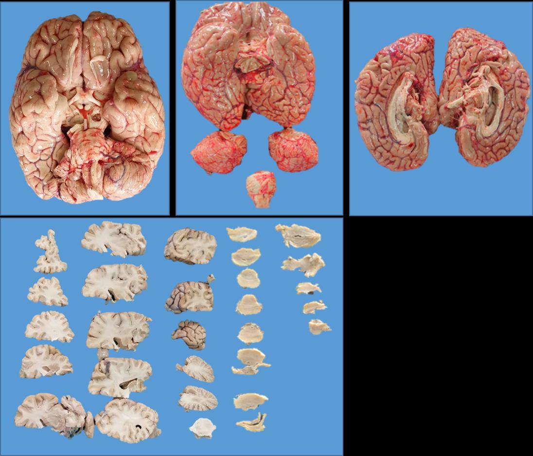 Brain Bank activity image 22