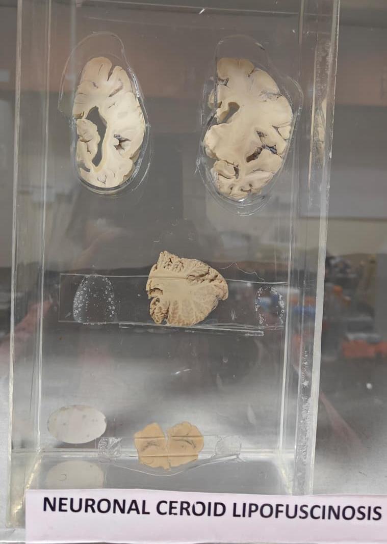 Brain Bank activity image 43