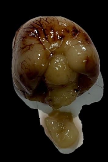 Brain Bank activity image 48