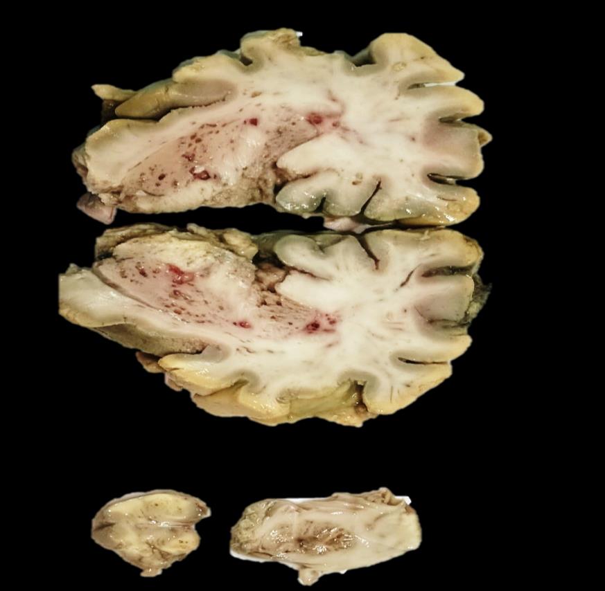 Brain Bank activity image 50