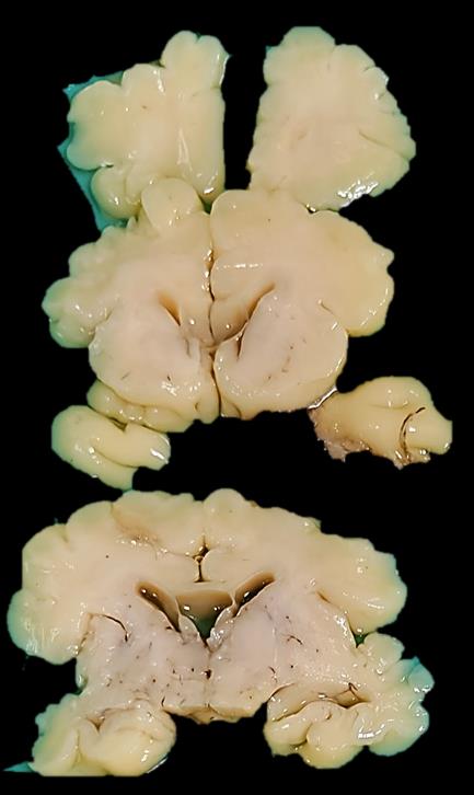 Brain Bank activity image 51