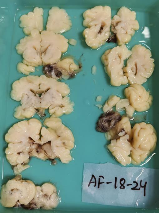 Brain Bank activity image 52