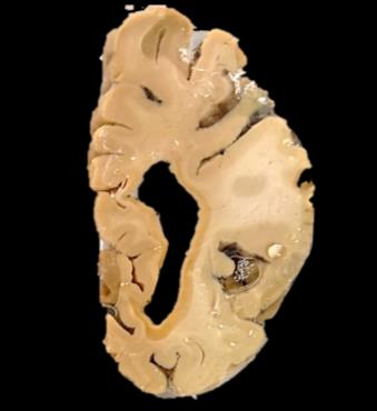 Brain Bank activity image 57