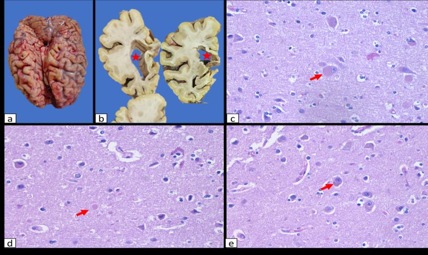 Brain Bank activity image 59