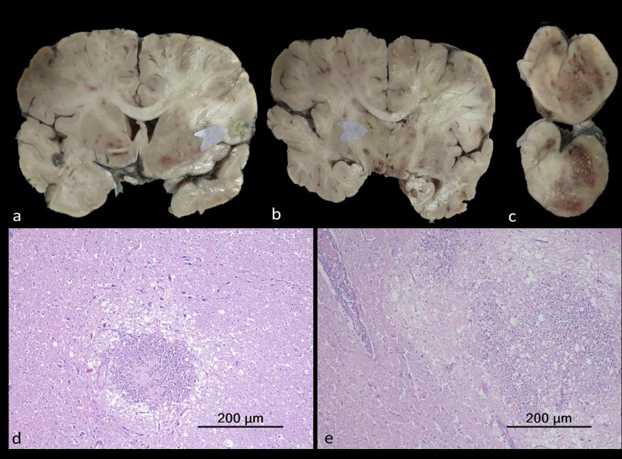 Brain Bank activity image 61
