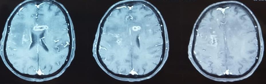 Brain Bank activity image 62